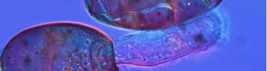 Incredible video shows all the stages of the liver fluke lifecycle
