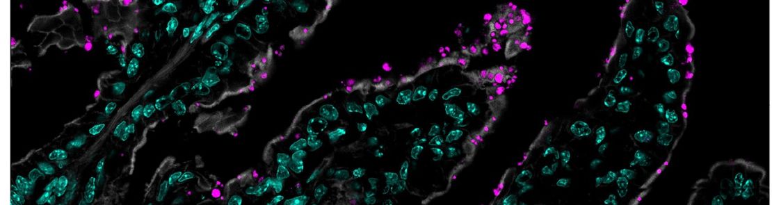 Cryptosporidium-in-mouse-gut-Pawlowic-Lab
