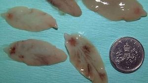 Adult liver fluke can be larger than a 5 pence piece